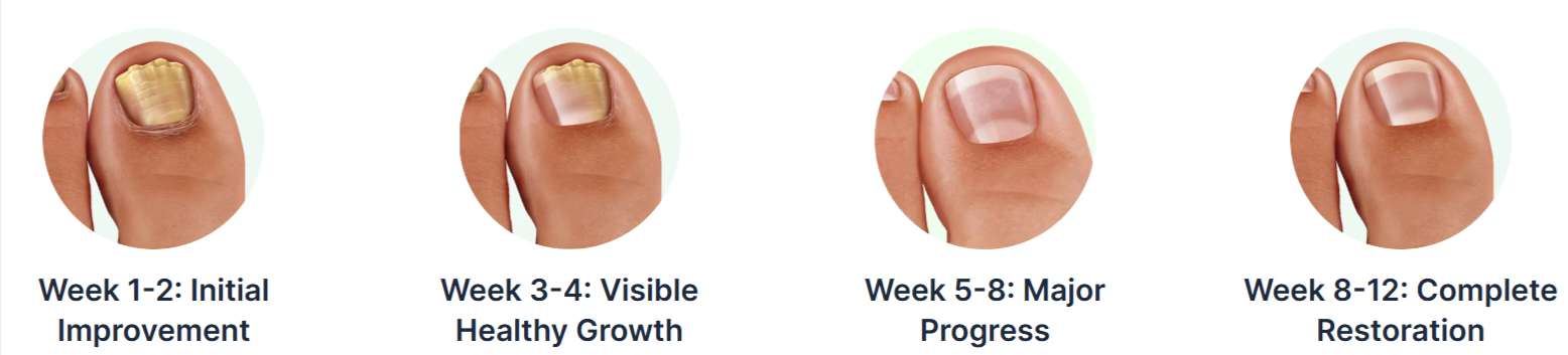 Dermafix Nail Fungus Treatment Gel Time results