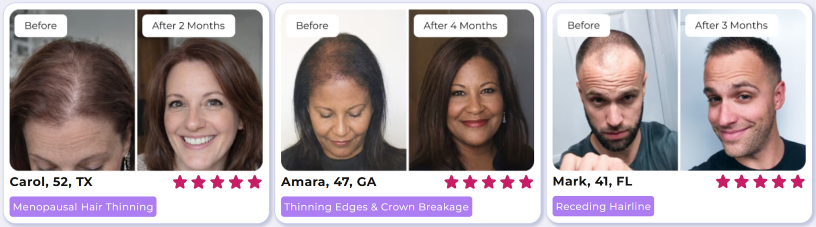 Scalpistry Real results